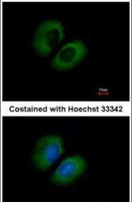 CACNA1B Antibody in Immunocytochemistry (ICC/IF)