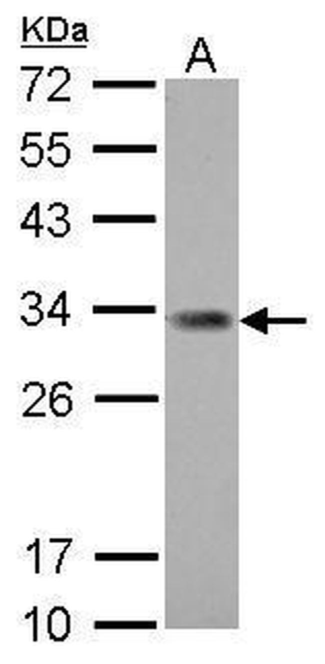ING5 Antibody in Western Blot (WB)