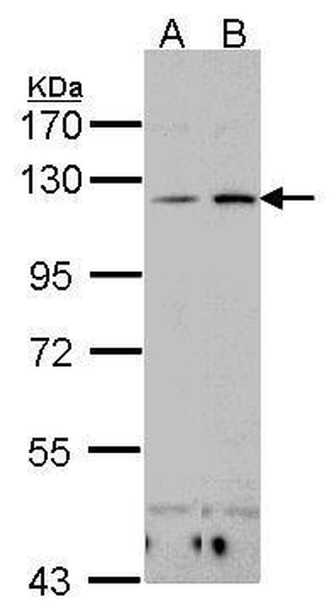 CD11c Antibody in Western Blot (WB)