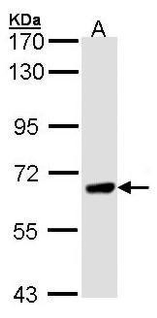 PPEF1 Antibody in Western Blot (WB)