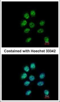 ZNF143 Antibody in Immunocytochemistry (ICC/IF)