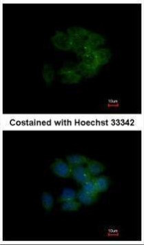 MRCK alpha Antibody in Immunocytochemistry (ICC/IF)