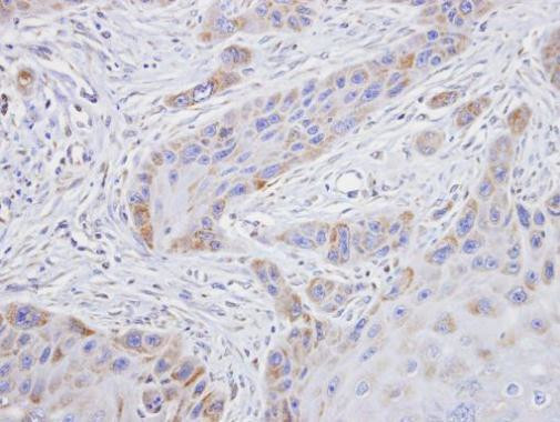 TROVE2 Antibody in Immunohistochemistry (Paraffin) (IHC (P))