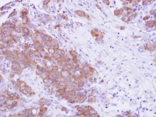 MPP3 Antibody in Immunohistochemistry (Paraffin) (IHC (P))