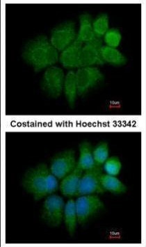 Cytokeratin 2e Antibody in Immunocytochemistry (ICC/IF)