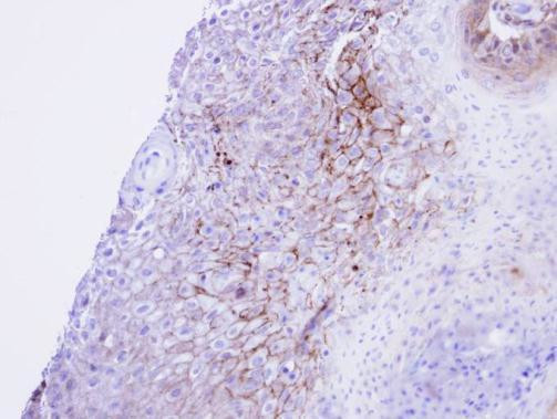 CaV1.1 Antibody in Immunohistochemistry (Paraffin) (IHC (P))
