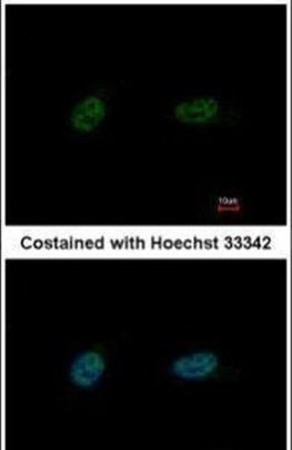 PARP3 Antibody in Immunocytochemistry (ICC/IF)