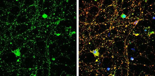Amphiphysin Antibody in Immunocytochemistry (ICC/IF)