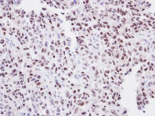 ORC2 Antibody in Immunohistochemistry (Paraffin) (IHC (P))