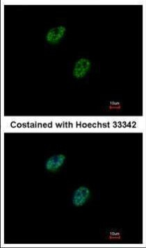GABPB1 Antibody in Immunocytochemistry (ICC/IF)
