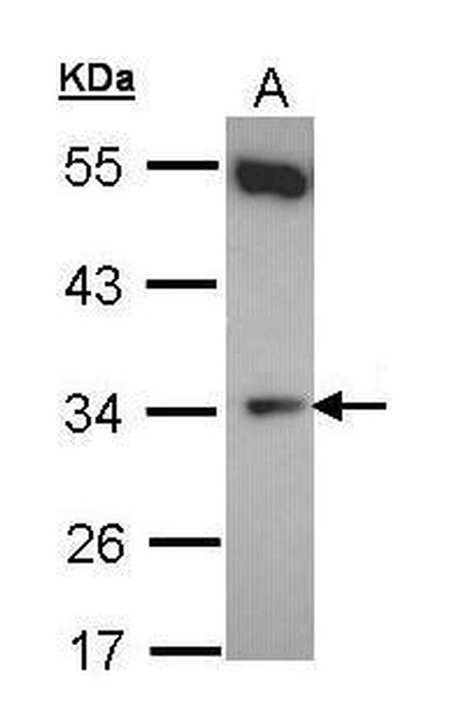 CYB5R1 Antibody in Western Blot (WB)