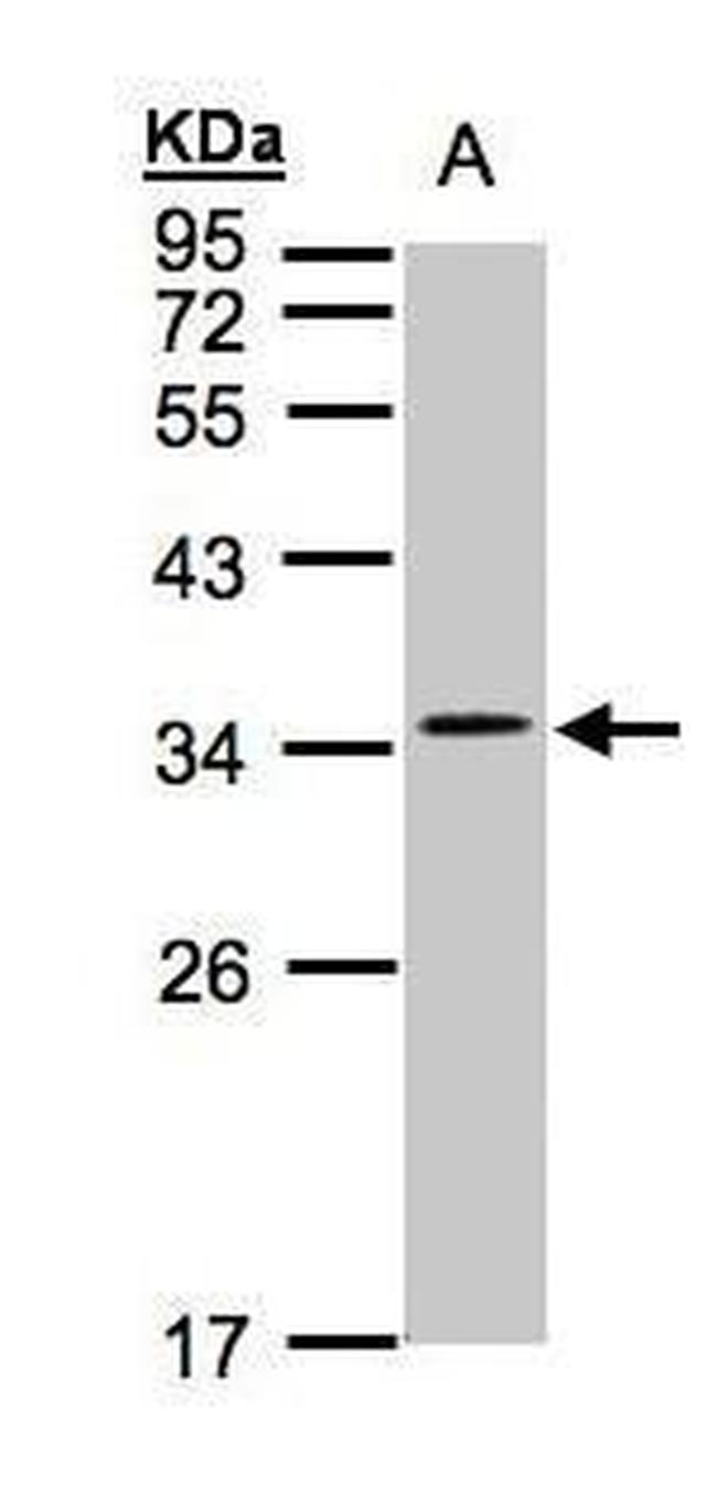 CACNG5 Antibody in Western Blot (WB)