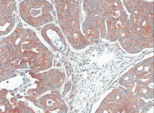 MPI Antibody in Immunohistochemistry (Paraffin) (IHC (P))