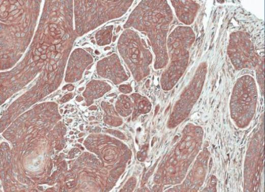 FGFR5 Antibody in Immunohistochemistry (Paraffin) (IHC (P))