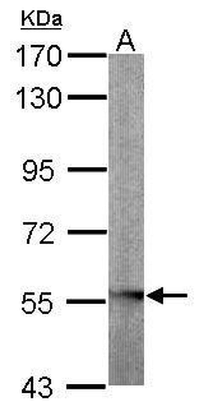 GLYCTK Antibody in Western Blot (WB)