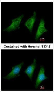 CD55 Antibody in Immunocytochemistry (ICC/IF)