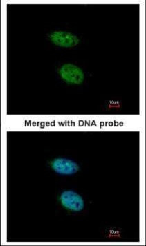 PRPS2 Antibody in Immunocytochemistry (ICC/IF)