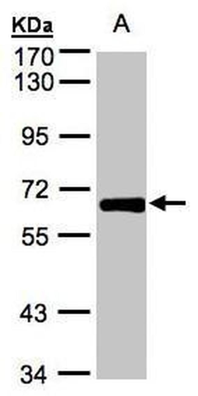 ZNF169 Antibody in Western Blot (WB)