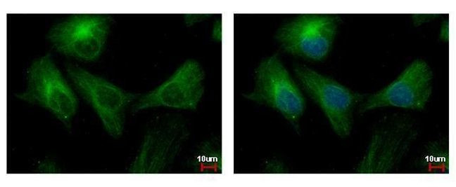 PPP3CB Antibody in Immunocytochemistry (ICC/IF)