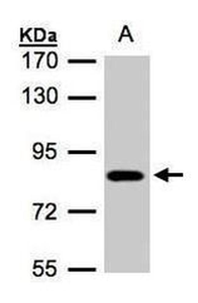 CLC-5 Antibody in Western Blot (WB)