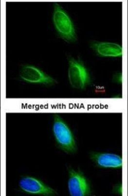 MTMR4 Antibody in Immunocytochemistry (ICC/IF)