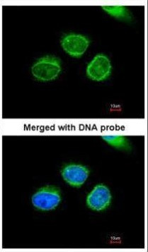 AKR7A2 Antibody in Immunocytochemistry (ICC/IF)