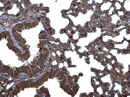 CLIC3 Antibody in Immunohistochemistry (Paraffin) (IHC (P))
