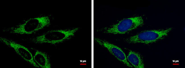 Adenylate Kinase 4 Antibody in Immunocytochemistry (ICC/IF)