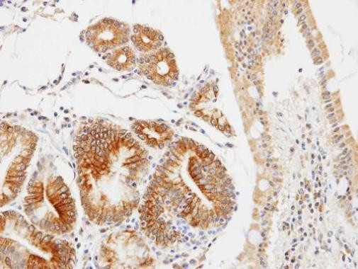 C17orf25 Antibody in Immunohistochemistry (Paraffin) (IHC (P))