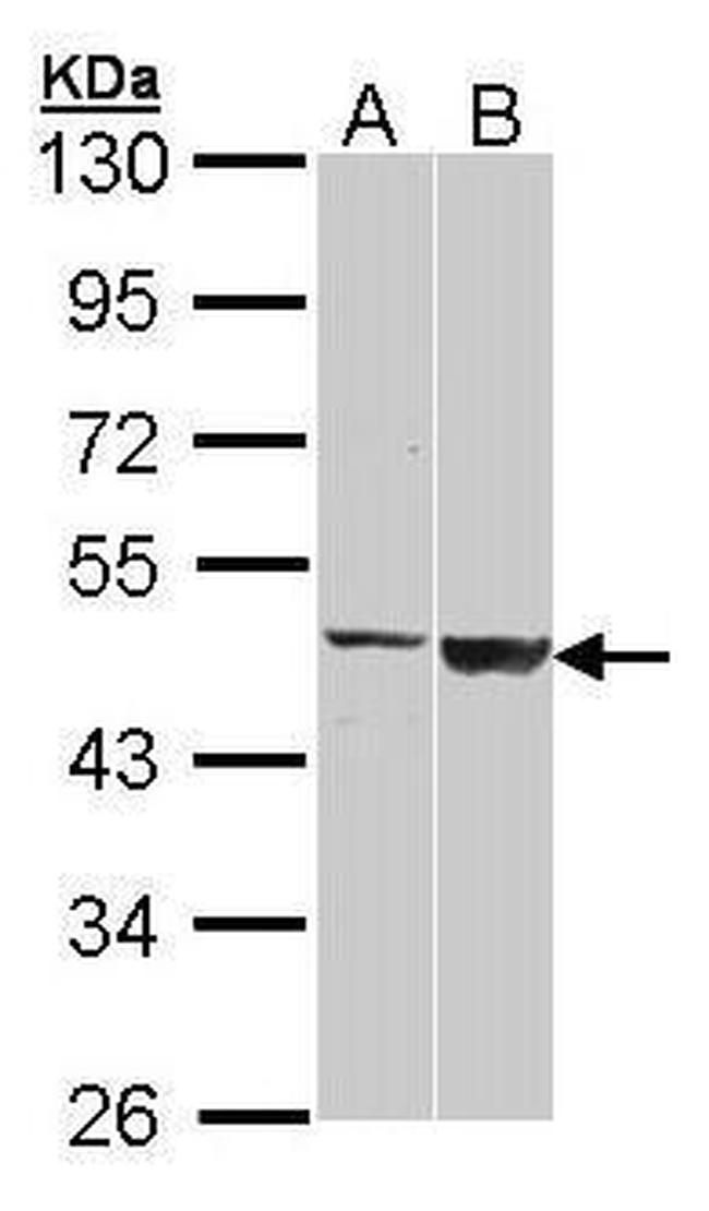 GAL3ST1 Antibody in Western Blot (WB)
