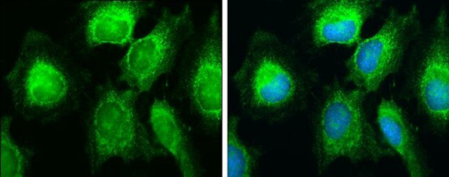 SDHB Antibody in Immunocytochemistry (ICC/IF)