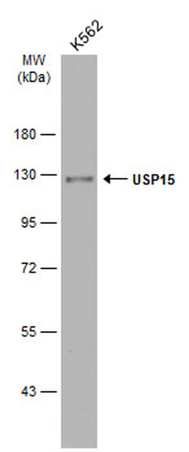 USP15 Antibody in Western Blot (WB)