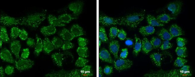 CLPP Antibody in Immunocytochemistry (ICC/IF)