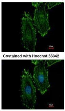 RASGRP4 Antibody in Immunocytochemistry (ICC/IF)