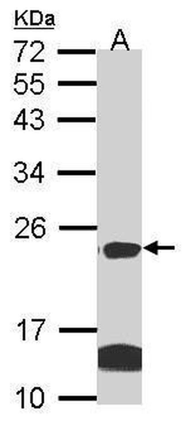 claudin 14 Antibody in Western Blot (WB)