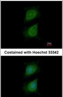 PLXND1 Antibody in Immunocytochemistry (ICC/IF)