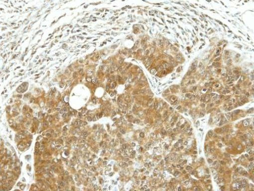 ARF1 Antibody in Immunohistochemistry (Paraffin) (IHC (P))