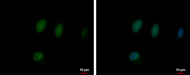 TFEC Antibody in Immunocytochemistry (ICC/IF)
