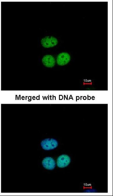TFE3 Antibody in Immunocytochemistry (ICC/IF)