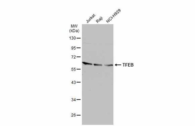 TFEB Antibody in Western Blot (WB)