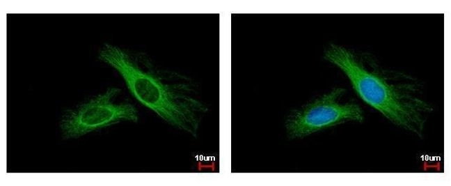 FBXL6 Antibody in Immunocytochemistry (ICC/IF)