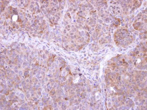 FBXL12 Antibody in Immunohistochemistry (Paraffin) (IHC (P))