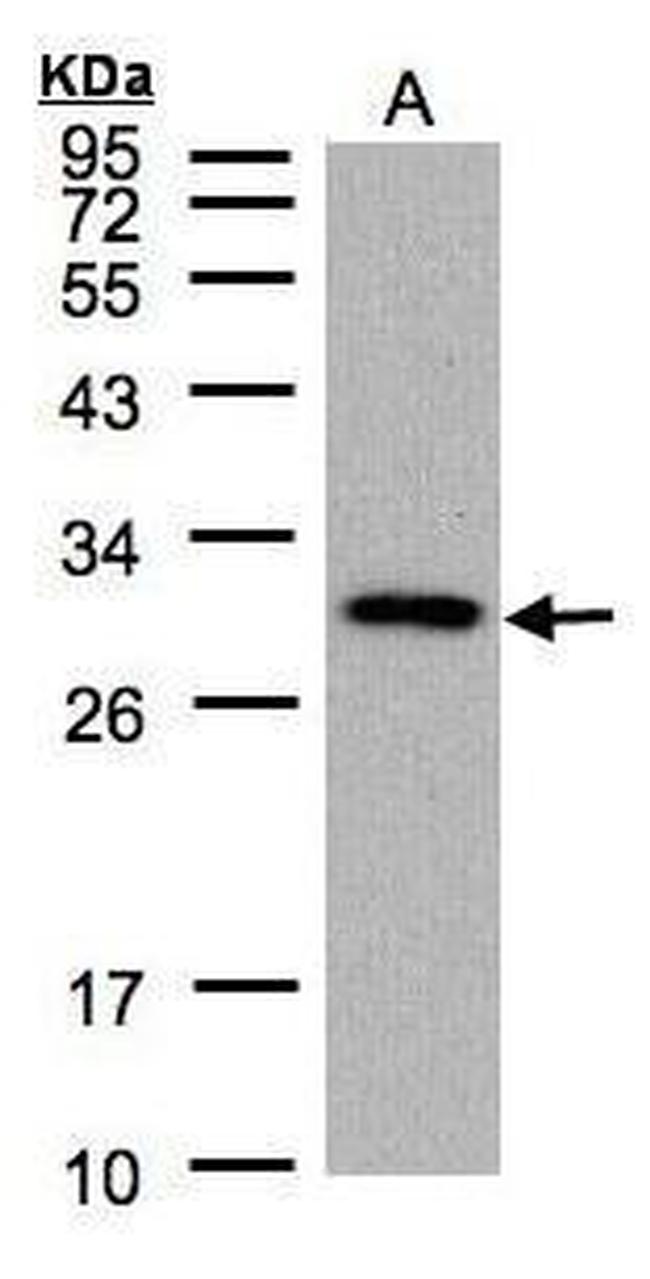 CTDSP2 Antibody in Western Blot (WB)