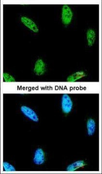 IPMK Antibody in Immunocytochemistry (ICC/IF)