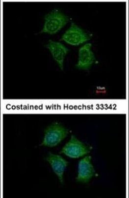 POMGNT1 Antibody in Immunocytochemistry (ICC/IF)