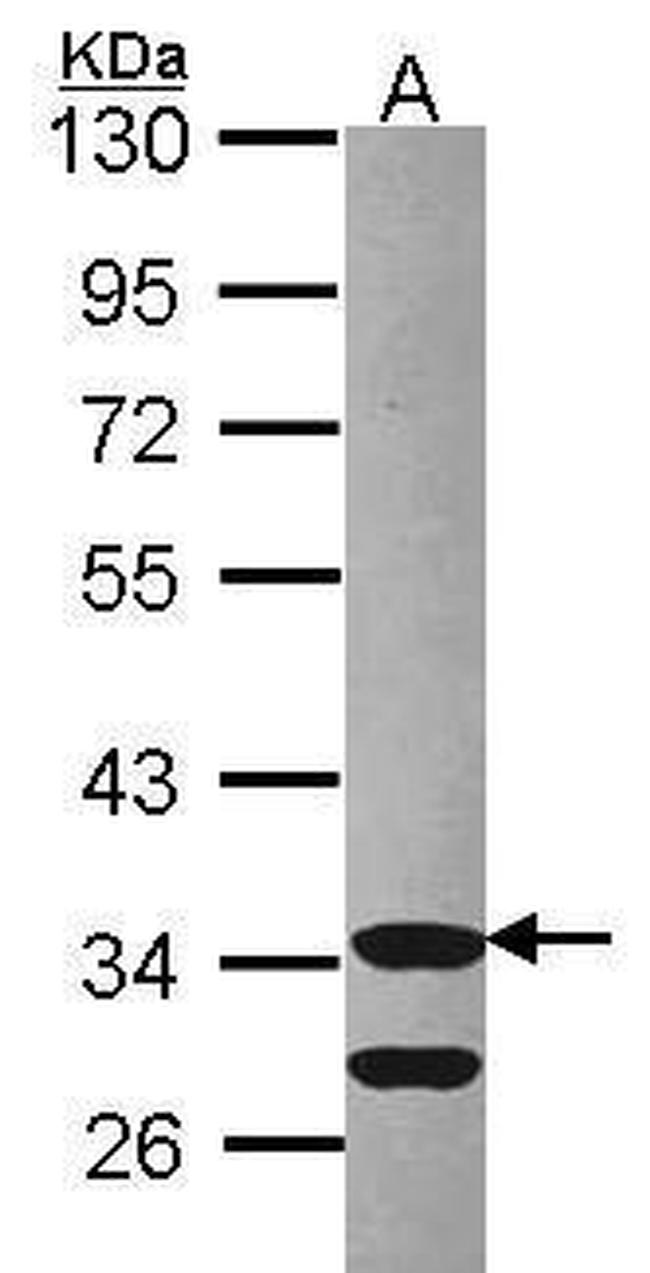 CDK3 Antibody in Western Blot (WB)