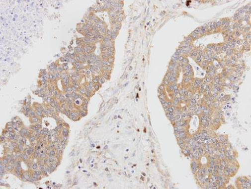 MSTO1 Antibody in Immunohistochemistry (Paraffin) (IHC (P))