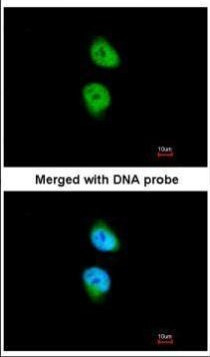 CAMK1D Antibody in Immunocytochemistry (ICC/IF)