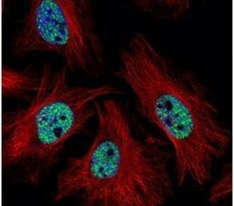 CMAS Antibody in Immunocytochemistry (ICC/IF)