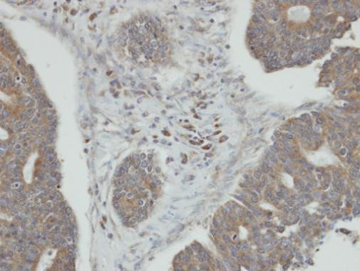 PPM1K Antibody in Immunohistochemistry (Paraffin) (IHC (P))